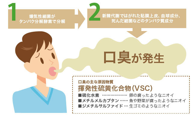 口臭の原因は3種類のガス