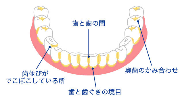 正しい歯の磨き方5